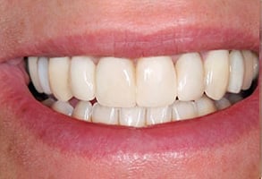 Before and After Photos