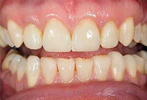 Before and After Photos