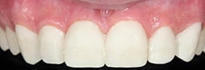 Before and After Photos