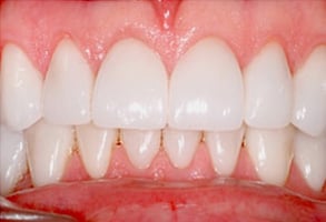 Before and After Photos