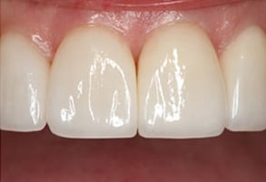 Before and After Photos