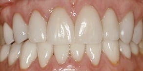 Before and After Photos