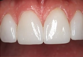 Before and After Photos