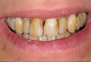 Before and After Photos