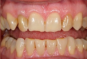Before and After Photos