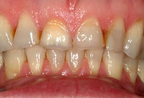 Before and After Photos