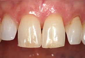 Before and After Photos