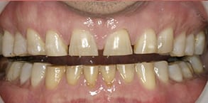 Before and After Photos