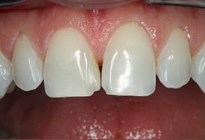 Before and After Photos